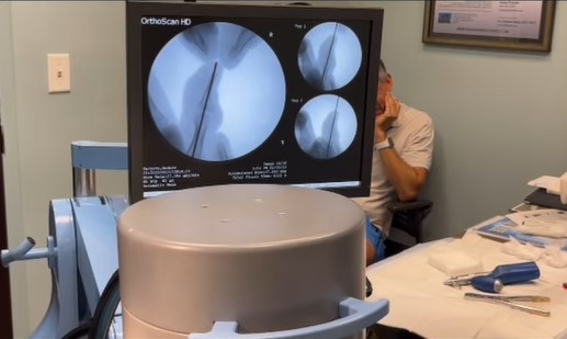 orthonow patient fracture pinning