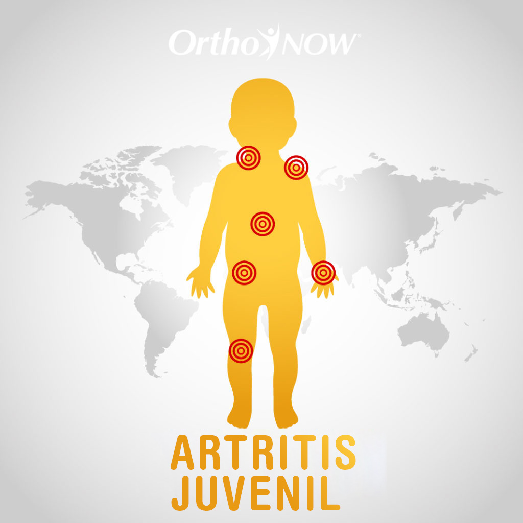 juvenile arthritis
