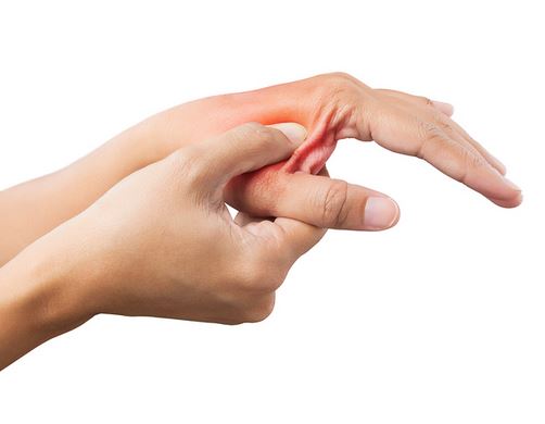 Flexor Tendon Injuries