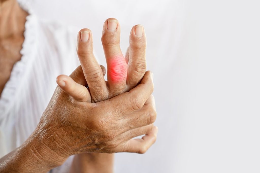 Diagnosing arthritis