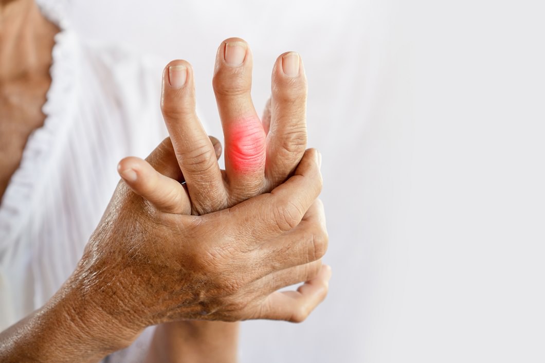 What to Do If You Have Arthritis Symptoms Such as Pain, Stiffness, or Swelling In Or Around One or More of Your Joints?