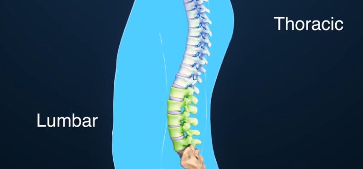 Scoliosis