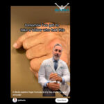 Dr. Badia Explains Finger Fractures & Why They Should Be Taken Seriously!
