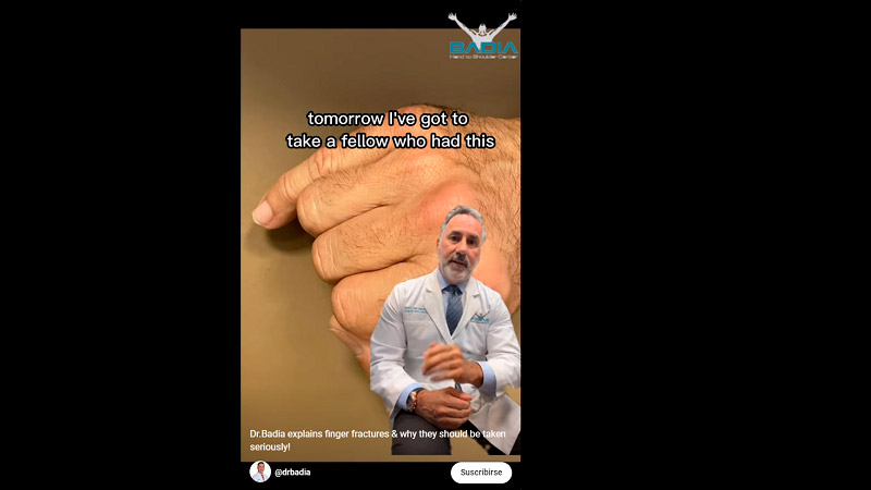 Dr. Badia Explains Finger Fractures & Why They Should Be Taken Seriously!