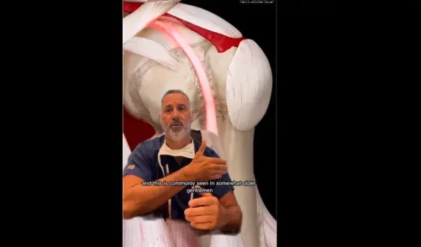 Orthopedic Surgeon Explains: Proximal Biceps Rupture Using 3D4Medical Animation